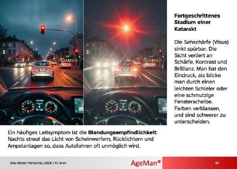 katarakt-blendung-blendempfindlichkeit.jpg