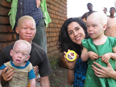 P176_Tailormade_sunscreen_for_people_with_albinism_Beyond _Suncare.jpg