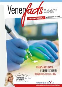 Behandlungsmethoden die moderne Krampfadertherapie