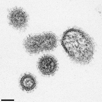 Influenza-A-Viren_Uniklinik_Freiburg (1).jpg