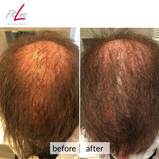 FitLine macht die Haare schön