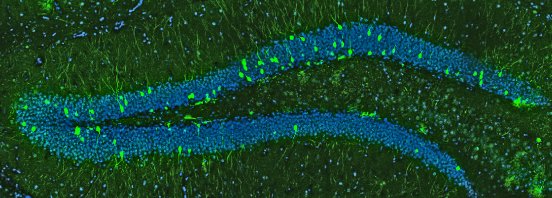 neugeborene Nervenzellen (grün) im Gehirn einer drei Monate alten Maus (Foto Ana Martin-Vil.jpg