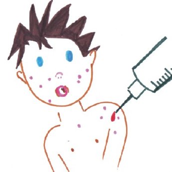 Masernimpfung.JPG