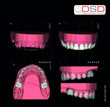 DSD auch für Implantologie.jpg