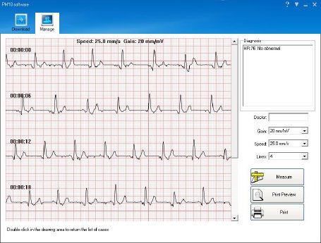 NX-4590_07_newgen_medicals_Mobiles_medizinisches_EKG-Messgeraet_mit_Software_Screen.jpg